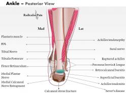 0514 ankle posterior medical images for powerpoint