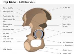 0514 hip bone lateral view medical images for powerpoint