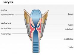 85414236 style medical 1 respiratory 1 piece powerpoint presentation diagram infographic slide