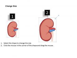 0514 location of right kidney medical images for powerpoint