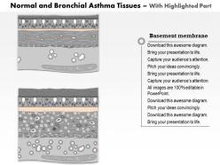 0514 normal and bronchial asthma tissues medical images for powerpoint