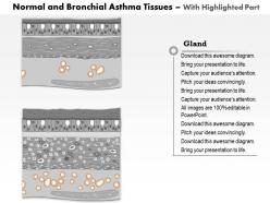 0514 normal and bronchial asthma tissues medical images for powerpoint