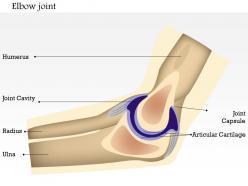 0714 elbow joint medical images for powerpoint