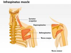 0714 infraspinatus muscle medical images for powerpoint