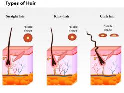 0814 types of hair medical images for powerpoint