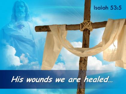 0514 isaiah 535 his wounds we are healed powerpoint church sermon